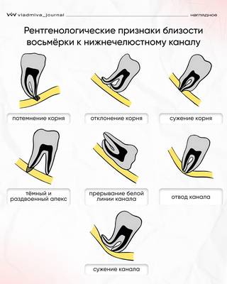 Мем